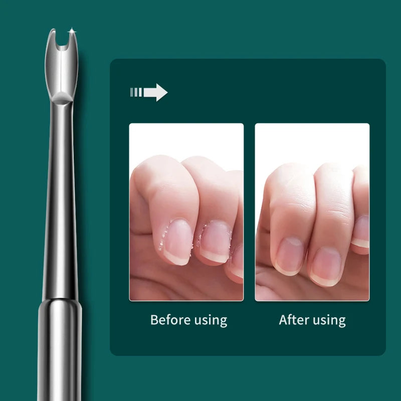 Surgical Grade Stainless Steel Cuticle Remover