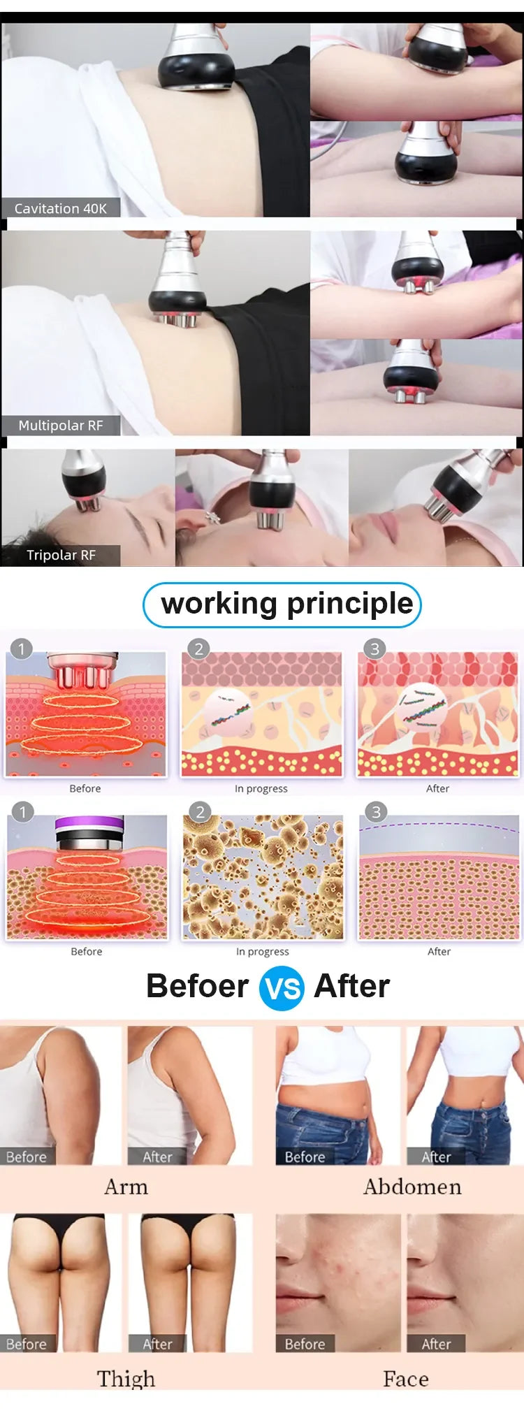 40K Ultrasonic Body Firming Device