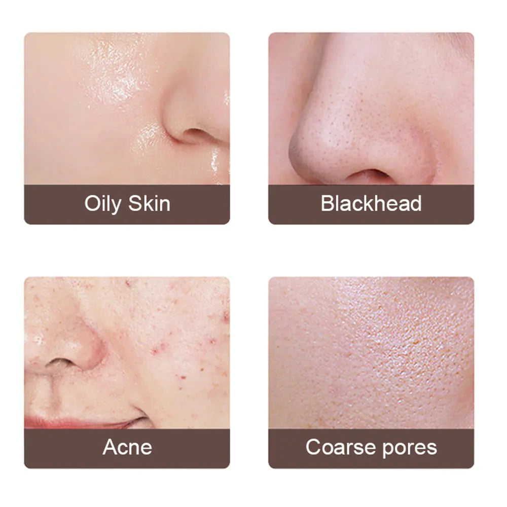 Face Spatula Pore Cleaner & Blackhead Remover Tools