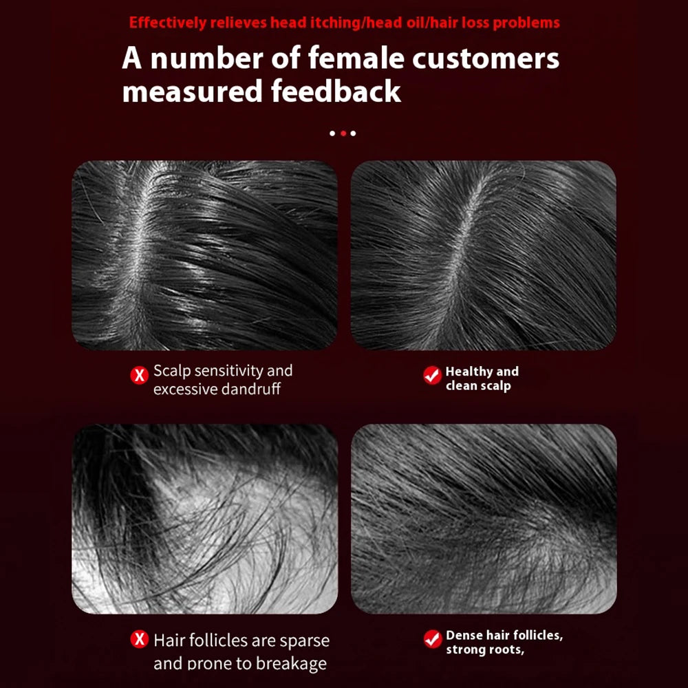 Electric Microcurrent Red Light Scalp & Hair Massage Brush