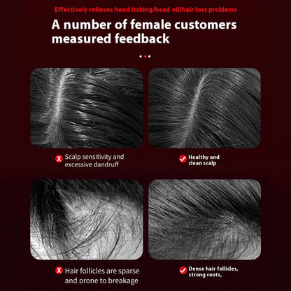 Electric Microcurrent Red Light Scalp & Hair Massage Brush